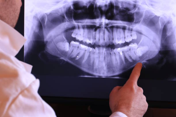 Best Emergency Gum Treatment in Kotzebue, AK